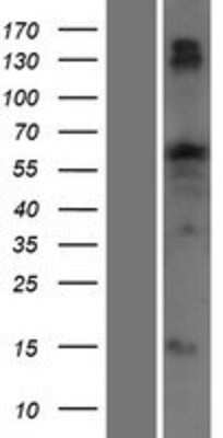 Western Blot: TTC22 Overexpression Lysate [NBP2-09394]