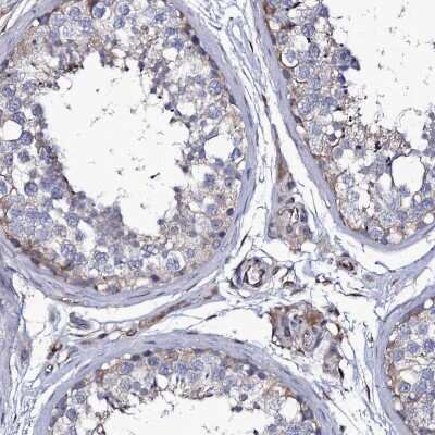 Immunohistochemistry-Paraffin: TTC23 Antibody [NBP1-83717]