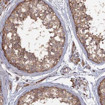 Immunohistochemistry-Paraffin: TTC23 Antibody [NBP1-83718]