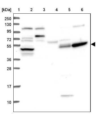 Western Blot: TTC23 Antibody [NBP1-83718]