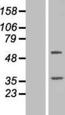 Western Blot: TTC23 Overexpression Lysate [NBP2-06381]