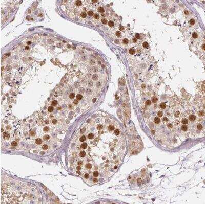 Immunohistochemistry-Paraffin: TTC23L Antibody [NBP1-83559]