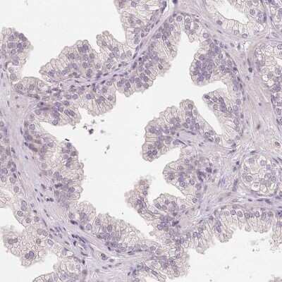 Immunohistochemistry-Paraffin: TTC23L Antibody [NBP1-83559]