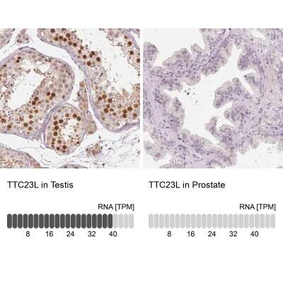 Immunohistochemistry-Paraffin: TTC23L Antibody [NBP1-83559]