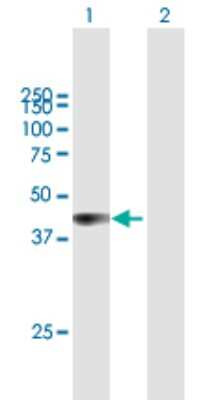 Western Blot: TTC23L Antibody [H00153657-B01P]