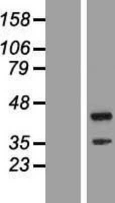 Western Blot: TTC23L Overexpression Lysate [NBL1-10761]