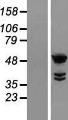 Western Blot: TTC25 Overexpression Lysate [NBL1-17402]