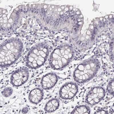 Immunohistochemistry-Paraffin: TTC26 Antibody [NBP1-84035]