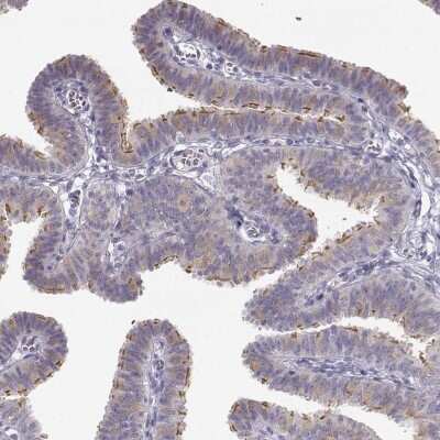 Immunohistochemistry-Paraffin: TTC26 Antibody [NBP1-84035]