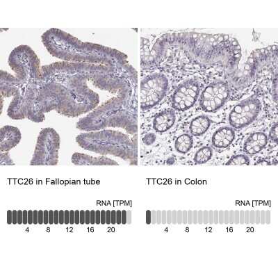 Immunohistochemistry-Paraffin: TTC26 Antibody [NBP1-84035]