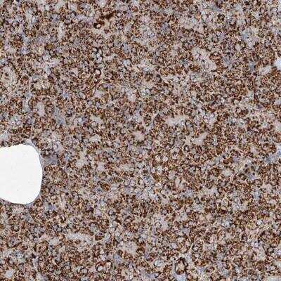 Immunohistochemistry-Paraffin: TTC27 Antibody [NBP1-82195]