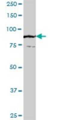 Western Blot: TTC27 Antibody [H00055622-B01P]