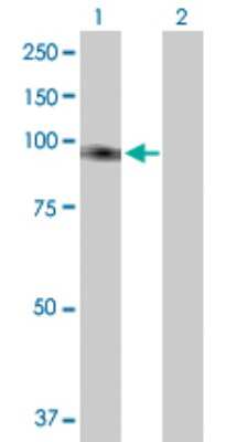 Western Blot: TTC27 Antibody [H00055622-B01P]