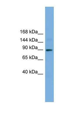 Western Blot: TTC27 Antibody [NBP1-79659]