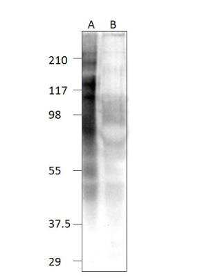 Western Blot: TTC27 Antibody [NBP3-12428]