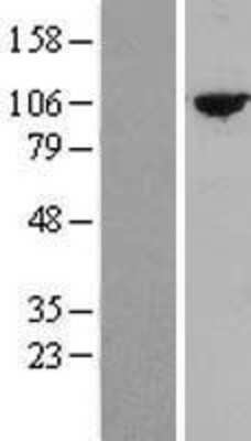 Western Blot: TTC27 Overexpression Lysate [NBL1-17403]