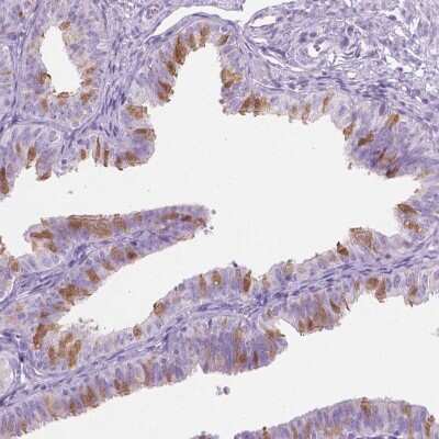 Immunohistochemistry: TTC29 Antibody [NBP2-49336]