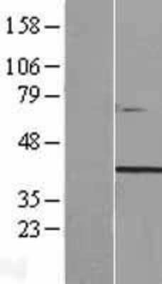 Western Blot: TTC29 Overexpression Lysate [NBP2-06091]