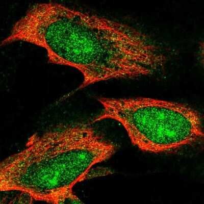 Immunocytochemistry/ Immunofluorescence: TTC3 Antibody [NBP2-55316]