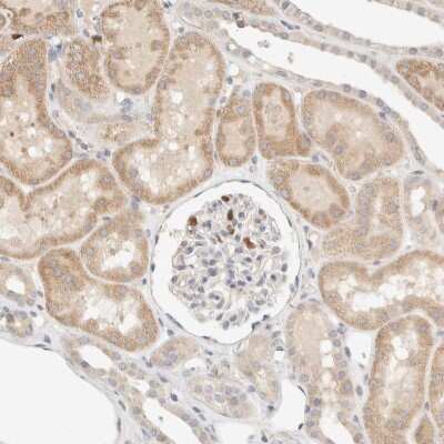 Immunohistochemistry-Paraffin: TTC3 Antibody [NBP1-84292]