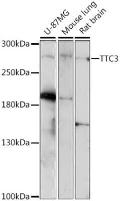 Western Blot: TTC3 AntibodyAzide and BSA Free [NBP2-93516]