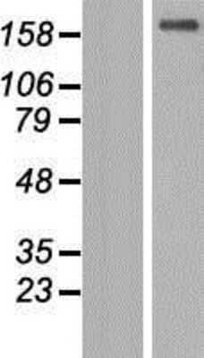 Western Blot: TTC3 Overexpression Lysate [NBP2-08963]