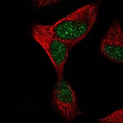 Immunocytochemistry/ Immunofluorescence: FLJ13946 Antibody [NBP2-46805]