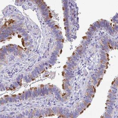 Immunohistochemistry: FLJ13946 Antibody [NBP2-46805]