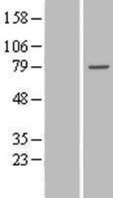 Western Blot: TTC30B Overexpression Lysate [NBL1-17406]