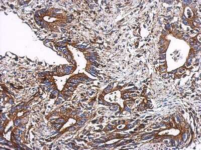Immunohistochemistry-Paraffin: TTC31 Antibody [NBP2-20754]