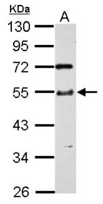 Western Blot: TTC31 Antibody [NBP2-20754]