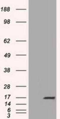 Western Blot: TTC32 Antibody (OTI1F7) [NBP2-02691]