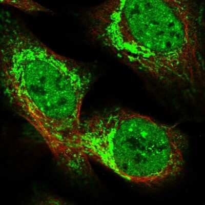 Immunocytochemistry/ Immunofluorescence: TTC32 Antibody [NBP1-86295]