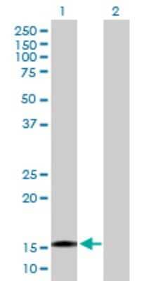 Western Blot: TTC32 Antibody [H00130502-B01P]