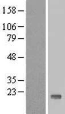 Western Blot: TTC32 Overexpression Lysate [NBL1-17407]