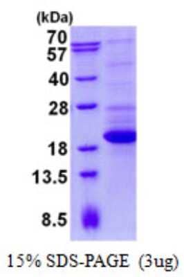 SDS-PAGE: Recombinant Human TTC32 His Protein [NBP2-22857]