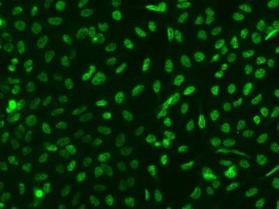 Immunocytochemistry/ Immunofluorescence: TTC33 Antibody [NBP2-97329]