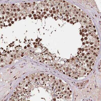 Immunohistochemistry-Paraffin: TTC33 Antibody [NBP1-82468]