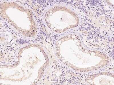 Immunohistochemistry-Paraffin: TTC33 Antibody [NBP2-99640]