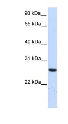 Western Blot: TTC33 Antibody [NBP1-55426]