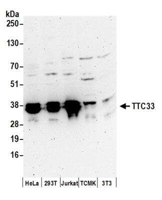 Western Blot: TTC33 Antibody [NBP2-37758]