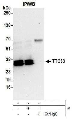 Western Blot: TTC33 Antibody [NBP2-37758]