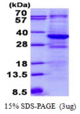 SDS-PAGE: Recombinant Human TTC33 His Protein [NBP2-22858]