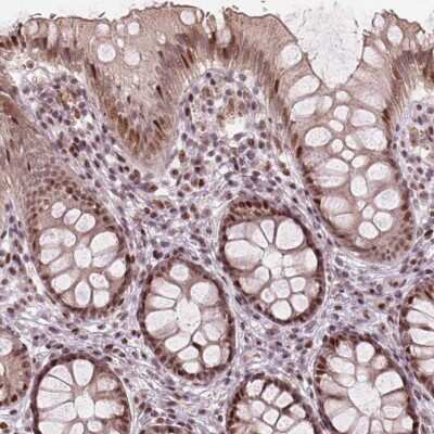 Immunohistochemistry: TTC34 Antibody [NBP2-49495]