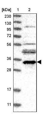 Western Blot: EMC2 Antibody [NBP2-13490]