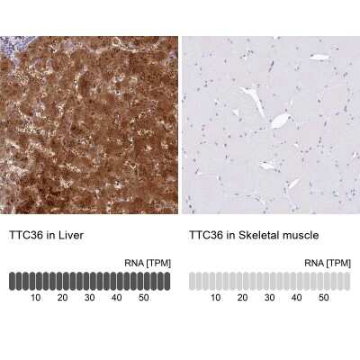 Immunohistochemistry-Paraffin: TTC36 Antibody [NBP1-93702]