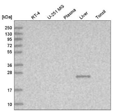 Western Blot: TTC36 Antibody [NBP1-93702]