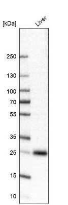 Western Blot: TTC36 Antibody [NBP1-93702]