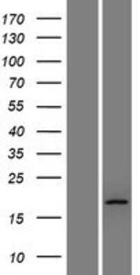 Western Blot: TTC36 Overexpression Lysate [NBP2-08498]