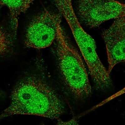 Immunocytochemistry/ Immunofluorescence: TTC37 Antibody [NBP1-93640]